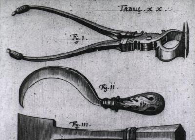 برگی از تاریخ: ابزار پزشکی رعب آور و عجیب قدیمی