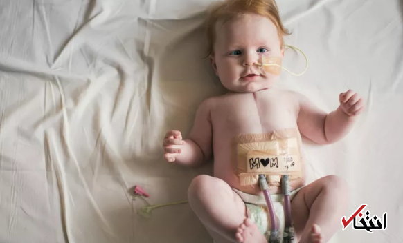 این دستگاه هوشمند می تواند نوزادان را از خطر مرگ نجات دهد